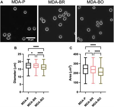 Morphological Phenotyping of Organotropic Brain- and Bone-Seeking Triple Negative Metastatic Breast Tumor Cells